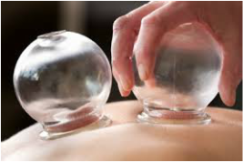 Cupping therapy on back